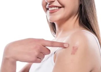 Keloid Treatment Abu Dhabi